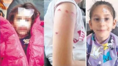 Ümraniye'de okulun bahçesinde 5 öğrenciyi ve 1 öğretmeni yaralayan köpeğin