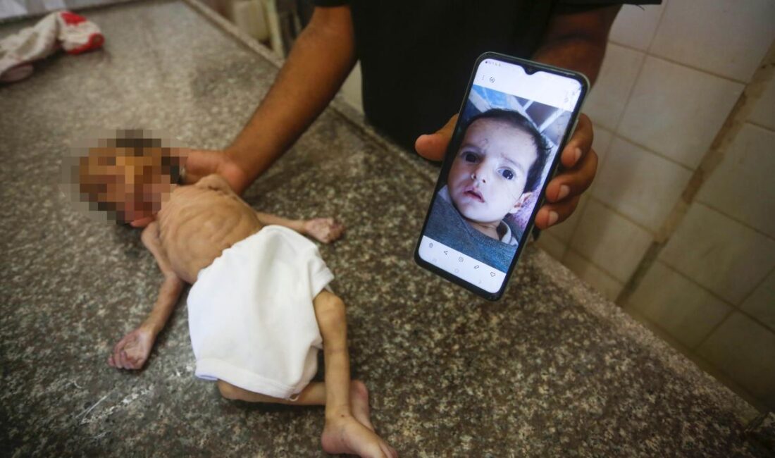 İsrail’in yardımları engellemesi nedeniyle bir bebek daha açlıktan can verdi.