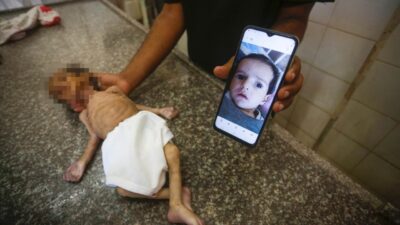 İsrail’in yardımları engellemesi nedeniyle bir bebek daha açlıktan can verdi.