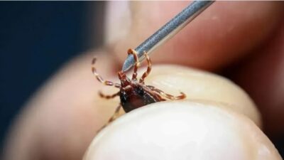 Kayseri’nin Tomarza ilçesinde kene ısırması sonucu hastaneye kaldırılan Ali Şimşek,